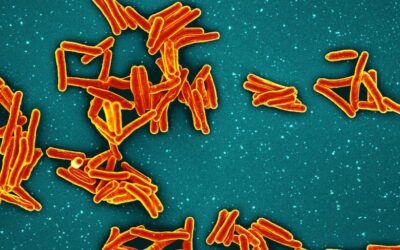 Tuberculosis: The World’s Deadliest Infectious Disease
